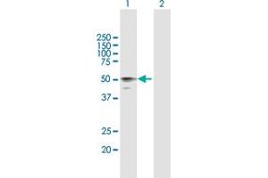 Western Blot analysis of HYAL3 expression in transfected 293T cell line by HYAL3 MaxPab polyclonal antibody. (HYAL3 Antikörper  (AA 1-417))