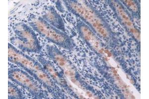 Figure. (OAS1 Antikörper  (AA 139-358))