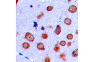 Immunohistochemical analysis of NMDAR1 staining in human brain formalin fixed paraffin embedded tissue section.