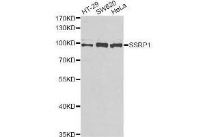 Western blot analysis of extracts of various cell lines, using SSRP1 antibody. (SSRP1 Antikörper  (AA 1-300))