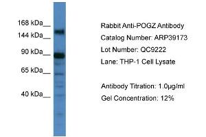 WB Suggested Anti-POGZ Antibody   Titration: 1.