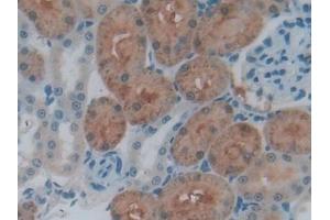 Immunohistochemistry (IHC) image for anti-Cathepsin L1 (CTSL1) (AA 114-288) antibody (ABIN7431587)