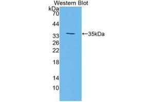 Western blot analysis of the recombinant protein. (TGM3 Antikörper  (AA 468-693))