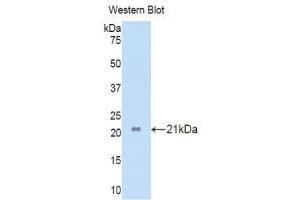Western Blotting (WB) image for anti-Interleukin 17 Receptor A (IL17RA) (AA 377-534) antibody (ABIN3206298) (IL17RA Antikörper  (AA 377-534))