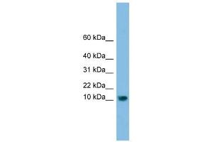 C13orf30 antibody used at 1 ug/ml to detect target protein. (C13orf30 Antikörper  (N-Term))