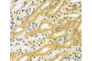 Immunohistochemistry of paraffin-embedded Mouse kidney using ADCK3 Polyclonal Antibody at dilution of 1:100 (40x lens). (COQ8A Antikörper)