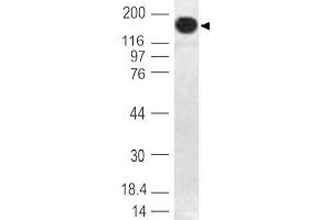 Image no. 1 for anti-DNA (Cytosine-5)-Methyltransferase 1 (DNMT1) (AA 128-429) antibody (ABIN5027163) (DNMT1 Antikörper  (AA 128-429))