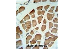 PDK2 Antibody (ABIN653784 and ABIN2843071) IHC analysis in formalin fixed and paraffin embedded skeletal muscle followed by peroxidase conjugation of the secondary antibody and DAB staining. (PDK2 Antikörper)