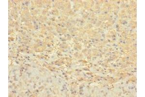 Immunohistochemistry of paraffin-embedded human adrenal gland tissue using ABIN7148072 at dilution of 1:100 (CCDC113 Antikörper  (AA 1-200))
