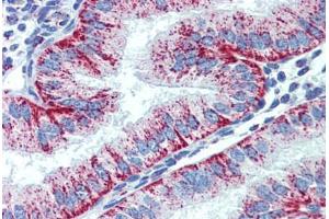 Human Uterus (formalin-fixed, paraffin-embedded) stained with HSPD1 antibody ABIN462364 followed by biotinylated anti-mouse IgG secondary antibody ABIN481714, alkaline phosphatase-streptavidin and chromogen. (HSPD1 Antikörper)
