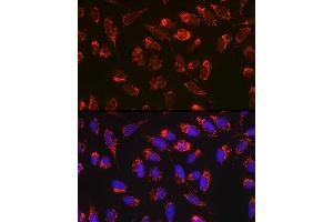 Immunofluorescence analysis of U-2 OS cells using Bax Rabbit mAb  at dilution of 1:100 (40x lens). (BAX Antikörper)