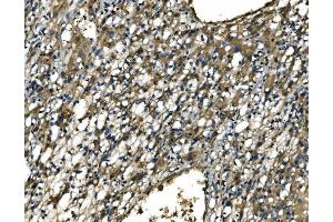 IHC analysis of CX3CR1 using anti-CX3CR1 antibody (ABIN7599293). (CX3CR1 Antikörper  (AA 1-345))