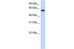 CDYL Antikörper  (N-Term)