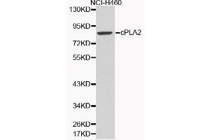 Western Blotting (WB) image for anti-Phospholipase A2, Group IVA (Cytosolic, Calcium-Dependent) (PLA2G4A) (AA 1-180) antibody (ABIN3020971) (PLA2G4A Antikörper  (AA 1-180))