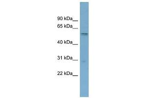 SLC7A11 antibody used at 1 ug/ml to detect target protein. (SLC7A11 Antikörper)