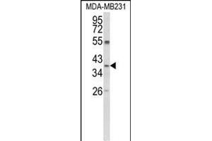 Western blot analysis of ARG1 Antibody (C-term) (ABIN652925 and ABIN2842593) in MDA-M cell line lysates (35 μg/lane). (Liver Arginase Antikörper  (C-Term))