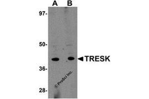 Western blot analysis of TRESK in rat brain tissue lysate with this product at (A) 1 and (B) 2 μg/ml.