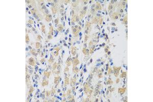 Immunohistochemistry of paraffin-embedded human stomach using VPS4A antibody (ABIN5974267) at dilution of 1/100 (40x lens). (VPS4A Antikörper)