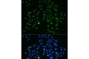 Immunofluorescence analysis of MCF7 cells using GNL3 Polyclonal Antibody (Nucleostemin Antikörper)