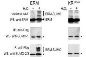 COS-7 cells were transfected for 24 hrs with a plasmid expressing FLAG-ERM (left panels) or FLAG-ERM KR12345 (right panels). (SUMO1 Antikörper  (AA 55-86))