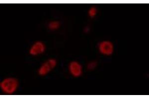 ABIN6274462 staining LOVO cells by IF/ICC. (FOXJ1 Antikörper  (Internal Region))