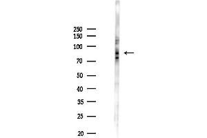 Western blot analysis of lysates from PC12 cells(LPS 4h treatment), using Phospho-Tau (Ser214) Antibody at 1/1000 dilution.