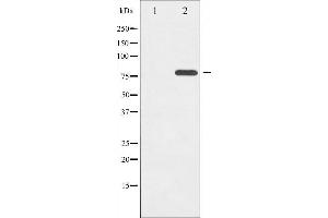 Western blot analysis of ETK phosphorylation expression in Serum treated HeLa whole cell lysates,The lane on the left is treated with the antigen-specific peptide.