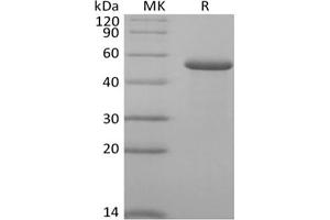 Western Blotting (WB) image for Reticulocalbin 2, EF-Hand Calcium Binding Domain (RCN2) protein (His tag) (ABIN7319916) (RCN2 Protein (His tag))