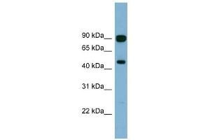 AGK antibody used at 1 ug/ml to detect target protein. (Acylglycerol Kinase Antikörper  (N-Term))