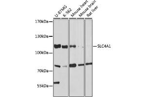 Western blot analysis of extracts of various cell lines, using SLC4 antibody (7391) at 1:1000 dilution. (Band 3/AE1 Antikörper  (AA 1-353))