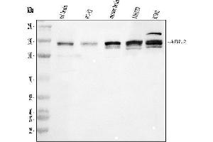 Western blot analysis of ABL2 using anti-ABL2 antibody (ABIN4886412).