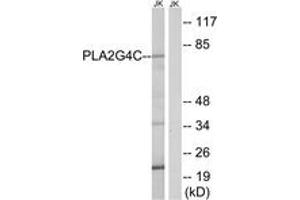 Western Blotting (WB) image for anti-Phospholipase A2, Group IVC (Cytosolic, Calcium-Independent) (PLA2G4C) (AA 301-350) antibody (ABIN2890254) (PLA2G4C Antikörper  (AA 301-350))