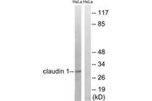 Western blot analysis of extracts from HeLa cells, treated with Hu 2nM 24h, using Claudin 1 (Ab-210) Antibody. (Claudin 1 Antikörper  (AA 162-211))