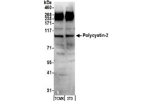 Western Blotting (WB) image for anti-Polycystic Kidney Disease 2 (Autosomal Dominant) (PKD2) (AA 918-968) antibody (ABIN7451972) (PKD2 Antikörper  (AA 918-968))