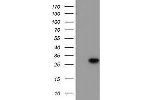 HEK293T cells were transfected with the pCMV6-ENTRY control (Left lane) or pCMV6-ENTRY BIN3 (Right lane) cDNA for 48 hrs and lysed. (BIN3 Antikörper)