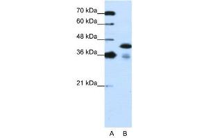 Western Blotting (WB) image for anti-TAR DNA Binding Protein (TARDBP) (C-Term) antibody (ABIN2780849)