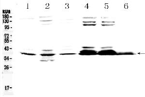 Western blot analysis of Musashi 1/Msi1 using anti- Musashi 1/Msi1 antibody .