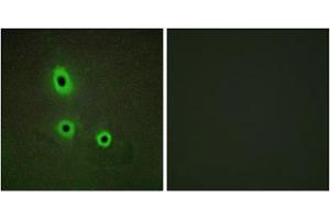 Immunofluorescence analysis of A549 cells, using EFNA5 antibody. (Ephrin A5 Antikörper  (Internal Region))
