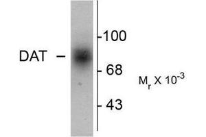 Image no. 1 for anti-Solute Carrier Family 6 (Neurotransmitter Transporter, Dopamine), Member 3 (SLC6A3) (C-Term) antibody (ABIN372613) (SLC6A3 Antikörper  (C-Term))