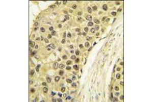 Immunohistochemistry (Paraffin-embedded Sections) (IHC (p)) image for anti-Cyclin A2 (CCNA2) (C-Term) antibody (ABIN359545)