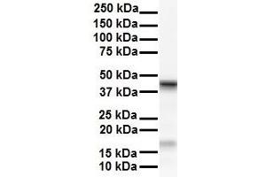 WB Suggested Anti-SMYD5 antibody Titration: 1 ug/mL Sample Type: Human HepG2 (SMYD5 Antikörper  (C-Term))
