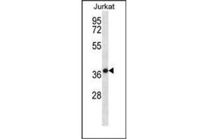 Western blot analysis of HSPBP1 Antibody (N-term) in Jurkat cell line lysates (35ug/lane). (HSPBP1 Antikörper  (N-Term))