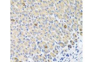 Immunohistochemistry of paraffin-embedded Mouse stomach using GLS Polyclonal Antibody at dilution of 1:100 (40x lens). (Glutaminase Antikörper)