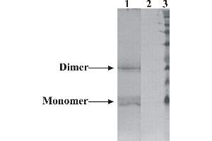 Western-Blot detection of human NRTN expressed in CHO cells. (Neurturin Antikörper)