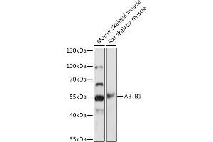 Western blot analysis of extracts of various cell lines, using  antibody  at 1:1000 dilution. (ABTB1 Antikörper)