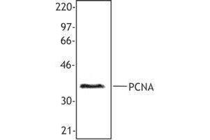 Western Blotting (WB) image for anti-Proliferating Cell Nuclear Antigen (PCNA) antibody (ABIN2665321) (PCNA Antikörper)