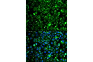 Immunofluorescence analysis of MCF7 cell using TMLHE antibody. (TMLHE Antikörper)