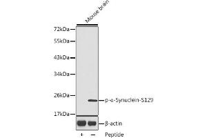 Western blot analysis of extracts from mouse brain tissue, using Phospho-α-Synuclein-S129 antibody (ABIN3020489, ABIN3020490, ABIN3020491 and ABIN1682058). (SNCA Antikörper  (pSer129))