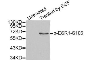 Western blot analysis of extracts from MCF7 cells, using Phospho-ESR1-S106 antibody (ABIN2988004). (Estrogen Receptor alpha Antikörper  (pSer106))