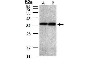 WB Image Sample(30 μg of whole cell lysate) A:HeLa S3, B:Hep G2, 12% SDS PAGE antibody diluted at 1:2000 (Annexin V Antikörper)